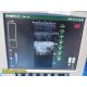 Chison Medical SR-6 Linear Array Vascular (L-VA) Imaging Probe ~ 36097