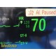 Philips Intellivue MP70 Critical Care Monitor W/ MMS Module & NEW Leads ~ 36844