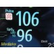 2014 Philips MP30 (M8002A) Anesthesia Monitor W/ MMS Module & NEW Leads ~ 36849