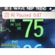 2011 Philips MP30 (M8002A) Anesthesia Monitor W/ MMS Module & NEW Leads ~ 36837