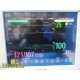 Philips MP70 (M8007A) Patient Monitor W/ MMS+Print Modules & NEW Leads ~ 36840