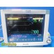 Philips MP70 (M8007A) Patient Monitor W/ MMS+Print Modules & NEW Leads ~ 36840