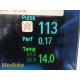 2011 Philips Intellivue MP70 (M8007A) Monitor W/ M3001A Module & Leads ~36838