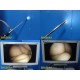 Olive Arthroscopy Tower W/ OVB1 HD CCU,300X OLED,TCK1-HD Camera,OHD2,Cart ~36794