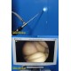 Olive Arthroscopy Tower W/ OVB1 HD CCU,300X OLED,TCK1-HD Camera,OHD2,Cart ~36794