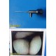 Smith & Nephew DYONICS 3768 2.7mmx30° Video Rigid Telescope Arthroscope ~ 36797