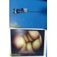 Smith & Nephew 3628 DYONICS 4mmx70° Video Rigid Telescope | Arthroscope ~ 36284