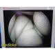 Smith & Nephew DYONICS Ref 3628 Video Rigid Arthroscope (4mm x 70°) ~ 36810