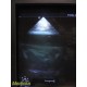 Philips S12-4 Ref 21780A Sector Array Ultrasound Probe P/N 989605361971 ~ 36813