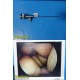 Smith & Nephew DYONICS 3626 4mmx30° Video Rigid Arthroscope | Telescope ~ 36812