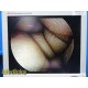 Smith & Nephew DYONICS 3626 4mmx30° Video Rigid Arthroscope | Telescope ~ 36812