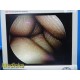 Smith & Nephew DYONICS 3626 4mmx30° Video Rigid Arthroscope | Telescope ~ 36812