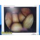 Smith & Nephew DYONICS 3626 4mmx30° Video Rigid Arthroscope | Telescope ~ 36812