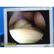 Smith & Nephew DYONICS 3626 4mmx30° Video Rigid Arthroscope | Telescope ~ 36812
