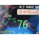 2009 Philips Intellivue MP30 (M8002A) Monitor W/ MMS Module & NEW Leads ~ 36869