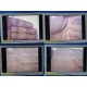 2012 Stryker 26" Vision Elect HDTV Surgical Monitor Ref 240-030-960 W/ PSU~36860