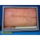 2009 Stryker Vision Elect HDTV 26" Surgical Monitor Ref 240-030-960 W/ PSU~36896