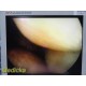 Smith & Nephew DYONICS 3896 ECTRA II Rigid Video Endoscope | 4mm x 30° ~ 36314