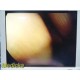 Smith & Nephew DYONICS 3896 ECTRA II Rigid Video Endoscope | 4mm x 30° ~ 36314