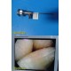 Smith & Nephew DYONICS 3896 ECTRA II Rigid Video Endoscope (4mm x 30°) ~ 36883