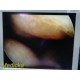 Smith & Nephew DYONICS 3896 ECTRA II Rigid Video Endoscope (4mm x 30°) ~ 36883
