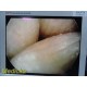 Smith & Nephew DYONICS 3896 ECTRA II Rigid Video Endoscope (4mm x 30°) ~ 36883