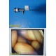 Smith & Nephew DYONICS 3896 ECTRA II Rigid Video Endoscope | 4mm x 30° ~ 36313