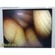 Smith & Nephew DYONICS 3896 ECTRA II Rigid Video Endoscope | 4mm x 30° ~ 36313