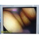 Smith & Nephew DYONICS 3896 ECTRA II Rigid Video Endoscope | 4mm x 30° ~ 36313