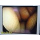 Smith & Nephew DYONICS 3896 ECTRA II Rigid Video Endoscope | 4mm x 30° ~ 36313