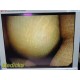 Stryker Ideal Eyes 502-205-045 Rigid Bariatric Laparoscope 5mm x 45° HD ~ 36878