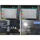 Spacelabs 91387 Ultraview CPU W/ CDA19T Monitor, CO2/Comm Modules & Leads ~36338