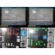 Spacelabs 91387 Ultraview CPU W/ CDA19T Monitor, CO2/Comm Modules & Leads ~36338
