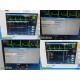 Siemens Infinity Gamma XL Monitor (CO2,NBP,SPO2,ECG,TEMP) W/ PSU & Leads ~ 36919