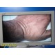 Conmed IM4123 TruHD 1080p Urology Camera Head W/ Coupler & Case ~ 36998