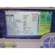 CASMED 750C-2MS Masimo SpO2 / CO2 Patient Monitor W/ SpO2 Sensor & Clamp~37060