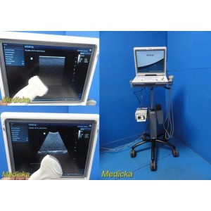 https://www.themedicka.com/22735-280512-thickbox/mindray-dp-50-ultrasound-system-w-2x-probes-sony-printer-mobile-cart-37123.jpg
