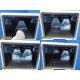 Mindray DP-50 Ultrasound System W/ 2X Probes, Sony Printer & Mobile Cart ~ 37123