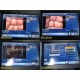 KARL STORZ 20205520 AIDA HD Connect Image Capture System W/ Smart Screen ~ 37156