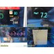 Philips MP70 (M8007A) Neonatal Patient Monitor W/ MMS Module & NEW Leads ~ 37231