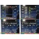 Fukuda Denshi DS-7200 Patient Monitor W/ NEW LEADS (ECG,NBP,SpO2,Temp,IBP)~37232