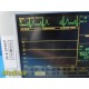 GE Dash 3000 Monitor (2xBP, SPO2, T/CO, CO2, NBP, ECG Print) W/ NEW Leads~37217