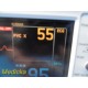 GE Dash 3000 (NBP,Temp,SpO2,ECG,CO2 Print) Patient Monitor W/ NEW Leads ~ 37212
