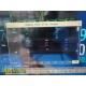 Philips MP70 (M8007A) Critical Care Monitor W/ MMS + Print Modules & Leads~37211