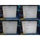 Philips MP30 (M8002A) Monitor W/ MMS Module & Leads ~ 37193