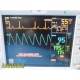 GE Dash 3000 Series Patient Monitor (NBP, Temp, SpO2 & ECG) W/ NEW Leads ~ 37247