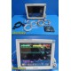 2012 Philips MP70 (M8007A) Patient Monitor W/ MMS Module & Leads ~ 37563
