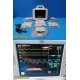 GE Dash 3000 Series (2xBP, SPO2, T/CO, CO2, NBP, ECG) Monitor & New Leads ~37237