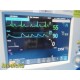 Philips Anesthesia Monitor W/ MMS Module & NEW Leads Print Opt ~ 37171