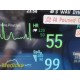 Philips Anesthesia Monitor W/ MMS Module & NEW Leads Print Opt ~ 37171